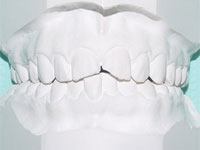 active_retainer1