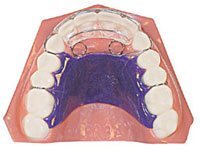 active_retainer3