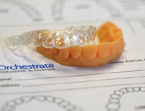 Orchestrate-invisalign