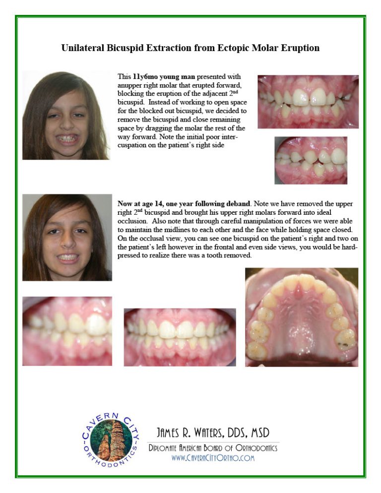 SmileGallery_AdolescentTreatment1024_30